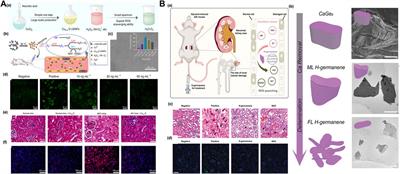 Nanosystems for oxidative stress regulation in the anti-inflammatory therapy of acute kidney injury